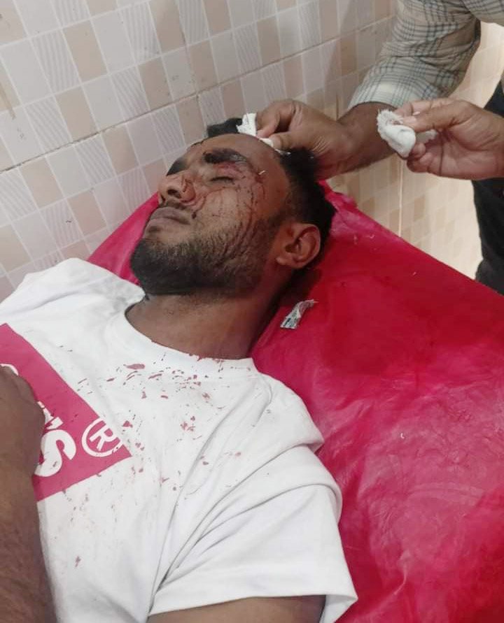 দরপত্র নিয়ে দ্বন্দ ছাত্রলীগ নেতাকে কুপিয়ে যখম