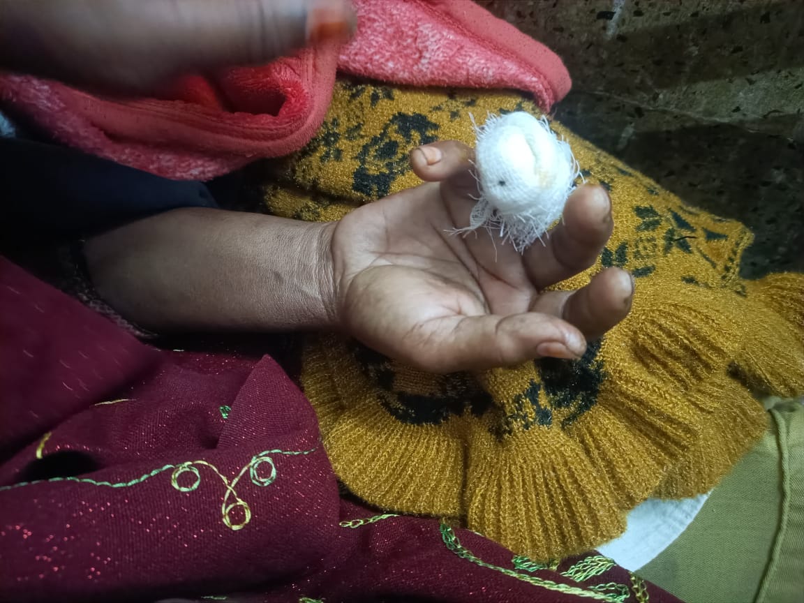 গুরুদাসপুরে লাউ গাছ লাগানো নিয়ে দ্বন্দে কামড়ে হাতের আঙ্গুল বিচ্ছিন্ন